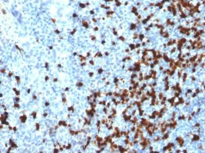 Immunohistochemistry-Paraffin: TCL1A Antibody (TCL1/2079) - Azide and BSA Free [NBP3-11312] - Formalin-fixed, paraffin-embedded human Tonsil stained with TCL1A Mouse Monoclonal Antibody (TCL1A/2079).