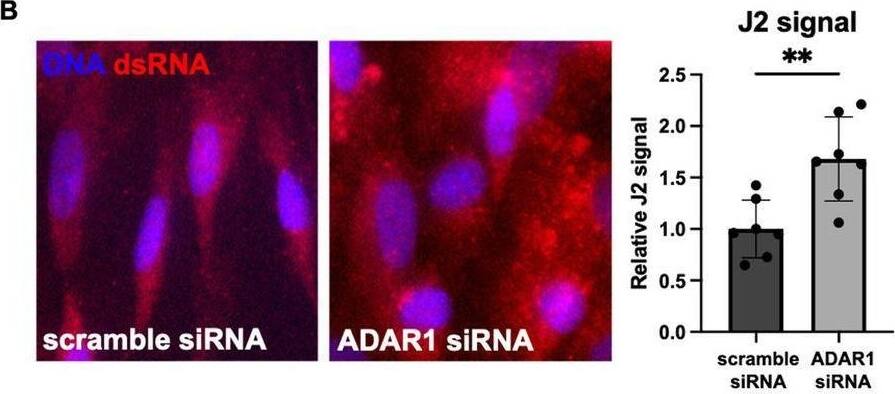 Immunocytochemistry/ Immunofluorescence dsRNA Antibody (J2) - Azide and BSA Free