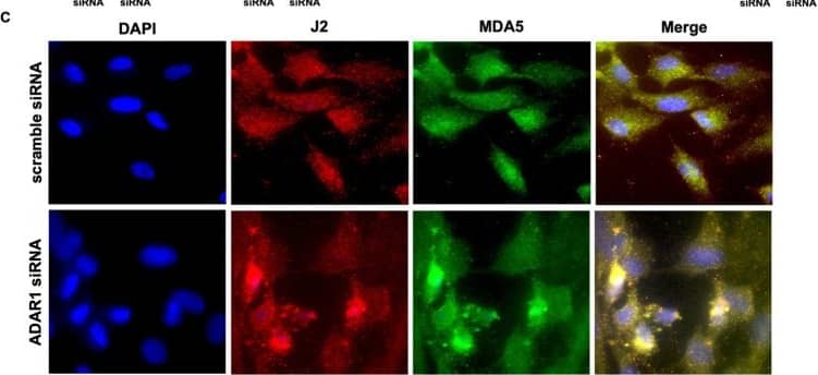Immunocytochemistry/ Immunofluorescence dsRNA Antibody (J2) - Azide and BSA Free