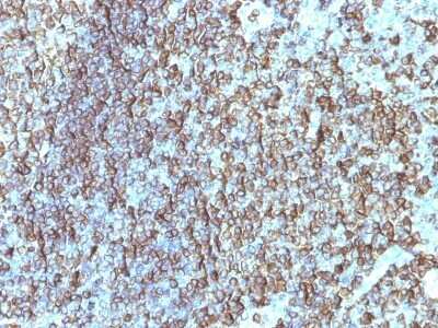 Immunohistochemistry-Paraffin: HLA DRB1 Antibody (SPM288) - Azide and BSA Free [NBP3-11419] - Human Tonsil stained with HLA-DRB Monoclonal Antibody (SPM288).