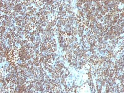 Immunohistochemistry-Paraffin: DNA Antibody (SPM603) - Azide and BSA Free [NBP3-11432] - Human Tonsil stained with Double Stranded DNA Monoclonal Antibody (SPM603)