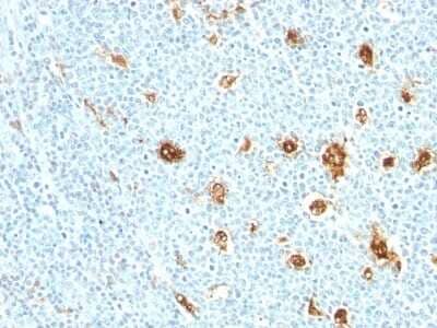 Immunohistochemistry-Paraffin: S100A9 Antibody (MRP14/840) - Azide and BSA Free [NBP3-11441] - Human Tonsil stained with MRP14 Monoclonal Antibody (MRP14/840)