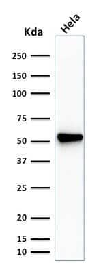 Western Blot: Fascin Antibody (SPM133) - Azide and BSA Free [NBP3-11444] - Western Blot Analysis of HeLa cell lysate Fascin Antibody (SPM133)