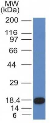Western Blot: CD117/c-kit Antibody (KIT/982) - Azide and BSA Free [NBP3-11446] - Recombinant fragment of CD117 with CD117 Monoclonal Antibody (KIT/982).