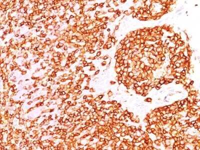 Immunohistochemistry-Paraffin: CD45RB Antibody (DF-B1) - Azide and BSA Free [NBP3-11447] - Human Tonsil stained with CD45RB Monoclonal Antibody (DF-B1).