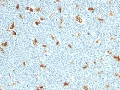 Immunohistochemistry-Paraffin: S100A9 Antibody (S100A9/1011) - Azide and BSA Free [NBP3-11453] - Human Tonsil stained with S100A9 Monoclonal Antibody (S100A9/1011)