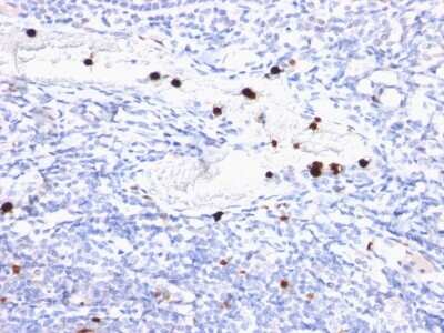 Immunohistochemistry-Paraffin: Myeloid-Associated Differentiation Marker Antibody (MYADM/972) - Azide and BSA Free [NBP3-11468] - Human Tonsil stained with MYDAM Monoclonal Antibody (MYADM/972).