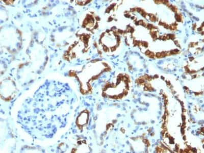 Immunohistochemistry-Paraffin: MFG-E8 Antibody (MFG-06) - Azide and BSA Free [NBP3-11473] - Formalin-fixed, paraffin-embedded human Renal Cell Carcinoma stained with MFG-E8 Antibody (MFG-06)