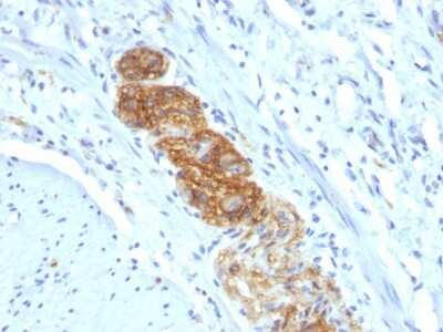 Immunohistochemistry-Paraffin: NCAM-1/CD56 Antibody (NCAM1/784) - Azide and BSA Free [NBP3-11475] - Human Colon stained with CD56 Monoclonal Antibody (NCAM1/784)