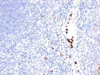Immunohistochemistry-Paraffin: Myeloid-Associated Differentiation Marker Antibody (MYADM/971) - Azide and BSA Free [NBP3-11489] - Human Tonsil stained with MYDAM Monoclonal Antibody (MYADM/971).