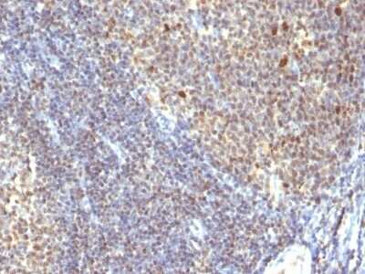 Immunohistochemistry-Paraffin: IPO-38 Antibody (SPM260) - Azide and BSA Free [NBP3-11492] - Human Tonsil stained with IPO38 Monoclonal Antibody (SPM260).