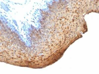 Immunohistochemistry-Paraffin: Cytokeratin 10/13 Antibody (DE-K13) - Azide and BSA Free [NBP3-11497] - Human Tonsil stained with Cytokeratin 10/13 Monoclonal Antibody (DE-K13)