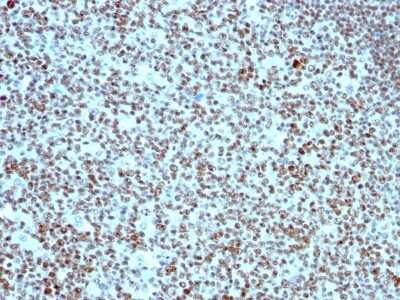 Immunohistochemistry-Paraffin: Nucleolin Antibody (SPM614) - Azide and BSA Free [NBP3-11498] - Human Tonsil stained with Nucleolin Monoclonal Antibody (SPM614).