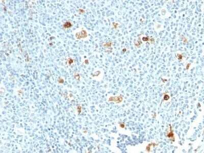 Immunohistochemistry-Paraffin: S100A9 Antibody (CPT/1028) - Azide and BSA Free [NBP3-11501] - Human Tonsil stained with Calprotectin Monoclonal Antibody (CPT/1028)