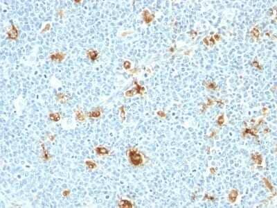 Immunohistochemistry-Paraffin: S100A9 Antibody (CAGB/426) - Azide and BSA Free [NBP3-11506] - Human Tonsil stained with Calgranulin B Monoclonal Antibody (CAGB/426)