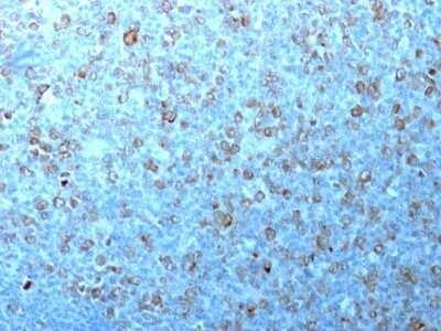 Immunohistochemistry-Paraffin: CDC2/CDK1 Antibody (CDK1/873) - Azide and BSA Free [NBP3-11507] - Human Tonsil stained with Cdk1 Monoclonal Antibody (CDK1/873).