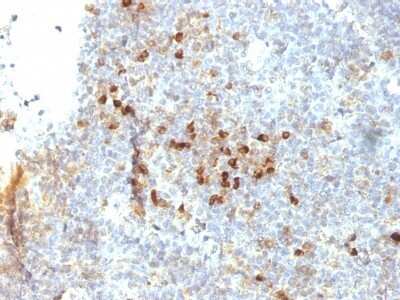 Immunohistochemistry-Paraffin: HLA DRA Antibody (19-26.1 (same as MB-26.1)) - Azide and BSA Free [NBP3-11518] - Human Tonsil stained with HLA-DRA Monoclonal Antibody (19-26.1).