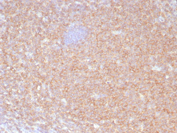 Formalin-fixed, paraffin-embedded human lymph node stained with HLA B antibody (JOAN-1). HIER: Tris/EDTA, pH9.0, 45min. Secondary: HRP-polymer, 30min. DAB, 5min.