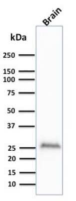 Western Blot: UCH-L1/PGP9.5 Antibody (UCHL1/841) - Azide and BSA Free [NBP3-11525] - Western Blot Analysis of human Brain lysate using UCH-L1/PGP9.5 Antibody (UCHL1/841)