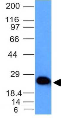 Western Blot: UCH-L1/PGP9.5 Antibody (UCHL1/841) - Azide and BSA Free [NBP3-11525] - Western Blot Analysis of human Brain lysate using UCH-L1/PGP9.5 Monoclonal Antibody (UCHL1/841).