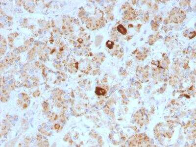 Immunohistochemistry-Paraffin: LH beta Antibody (SPM103) - Azide and BSA Free [NBP3-11530] - Formalin-fixed, paraffin-embedded human Pituitary stained with LH-beta Monoclonal Antibody (SPM103).