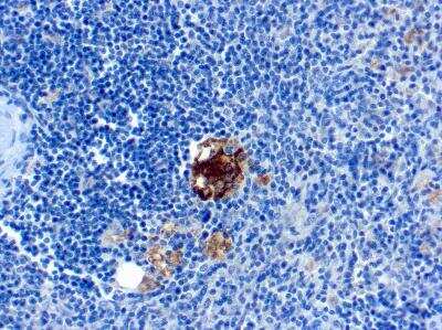 Immunohistochemistry-Paraffin: TRACP/PAP/ACP5 Antibody (SPM601) - Azide and BSA Free [NBP3-11536] - Formalin-fixed, paraffin-embedded human Spleen stained with TRAcP Monoclonal Antibody (SPM601).
