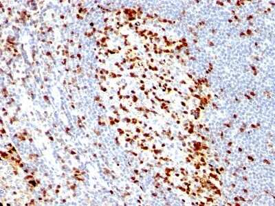 Immunohistochemistry-Paraffin: ZAP70 Antibody (ZAP70/528) - Azide and BSA Free [NBP3-11537] - Human Tonsil stained with ZAP70 Monoclonal Antibody (ZAP70/528).