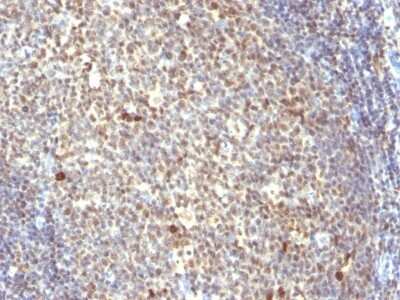 Immunohistochemistry-Paraffin: NuMA Antibody (SPM300) - Azide and BSA Free [NBP3-11547] - Human Tonsil stained with NuMA Monoclonal Antibody (SPM300)