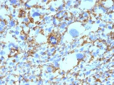 Immunohistochemistry-Paraffin: HLA DRB1 Antibody (SPM423) - Azide and BSA Free [NBP3-11552] - Human Histiocytoma stained with HLA-DRB Monoclonal Antibody (SPM423).
