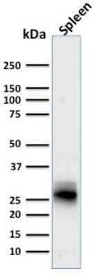 Western Blot: HLA DRB1 Antibody (SPM423) - Azide and BSA Free [NBP3-11552] - Western Blot Analysis of human Spleen tissue lysate using HLA DRB1 Antibody (SPM423).