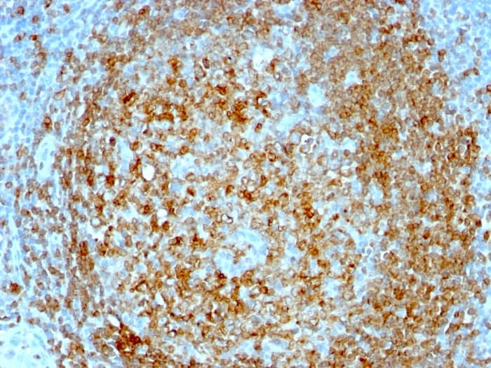 Formalin-fixed, paraffin-embedded human Tonsil stained with CD74 Antibody (CLIP/813) - Azide and BSA Free.