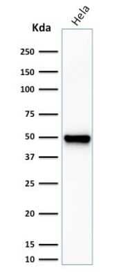 Western Blot: Fascin Antibody (FSCN1/416) - Azide and BSA Free [NBP3-11582] - Western Blot Analysis of HeLa cell lysate using Fascin Antibody (FSCN1/416).