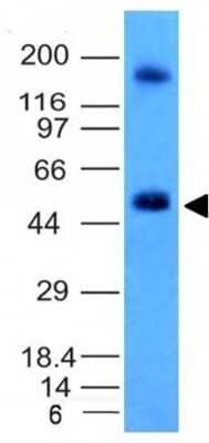 Western Blot: Carbonic Anhydrase IX/CA9 Antibody (CA9/781) - Azide and BSA Free [NBP3-11591] - Analysis of HCT116 Cell Lysate using CAIX Monoclonal Antibody (CA9/781). As indicated by the arrow, a specific band was detected at a molecular weight of approximately 50 kDa.