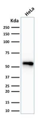 Western Blot: Cytokeratin 7 Antibody (SPM270) - Azide and BSA Free [NBP3-11594] - Western Blot Analysis of human HeLa cell lysate using Cytokeratin 7 Antibody (SPM270).