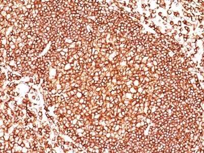 Immunohistochemistry-Paraffin: CD45 Antibody (136-4B5) - Azide and BSA Free [NBP3-11595] - Human Tonsil stained with CD45 antibody (136-4B5) [NBP2-44840].
