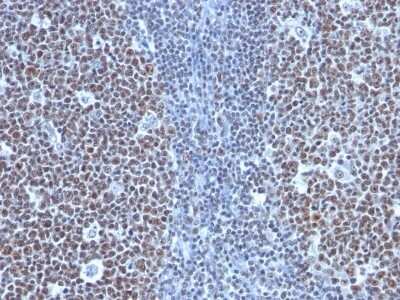 Immunohistochemistry-Paraffin: Cyclin B1 Antibody (SPM619) - Azide and BSA Free [NBP3-11598] - Human Tonsil stained with Cyclin B1 Monoclonal Antibody (SPM619)