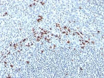 Immunohistochemistry-Paraffin: Kappa Light Chain Antibody (Kap-56) - Azide and BSA Free [NBP3-11599] - Human Tonsil stained with Kappa Light Chain Monoclonal Antibody (Kap-56).