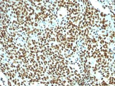 Immunohistochemistry-Paraffin: Nuclear Antigen Antibody (NM106) - Azide and BSA Free [NBP3-11613] - Human Tonsil stained with Pan Nuclear Antigen Antibody