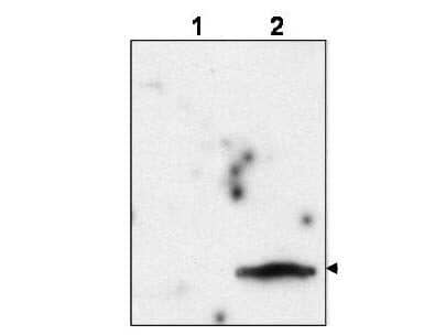 Western blot using affinity purified anti-FIV Matrix Protein p15 to detect p15 in the culture supernatant of FIV-infected feline CrFK cells (lane 2, arrowhead). Lane 1 is an uninfected control. Virions were enriched by ultracentrifugation, lysed, resolved by electrophoresis, and transferred to nitrocellulose. The membrane was probed with the primary antibody at a 1:10,000 dilution. Personal Communication, B. Luttge, CCR-NCI, Frederick, MD.