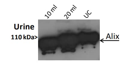 EV Precipitation Solution (Urine) [NBP3-11766] - Exosomes isolated from 10 ml and 20 ml of urine were resuspended in 24 ul of PBS 1X, and the entire amount was loaded with 6 ul of Laemmli Sample buffer 5X on acrylamide gel. Ultracentrifuged exosomes (30 ug) were used as control. Western blotting performed using anti-Alix (Catalog # NBP3-18364).