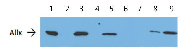 CD9 Immunobeads for Exosome Isolation [NBP3-11768] - Alix expression by western blotting of human plasma exosomes captured on lmmunobeads from 0.5 ml of plasma in comparison with exosomes purified via ultracentrifuge. 1, 3 and 5: lmmunocapture with immunobeads from 1 ml, 0.5 ml and 100 Âµ1 of human plasma respectively. 2, 4, 6: Ultra centrifuged exosomes from plasma after immunobeads capture. 7 lmmunocapture with immunobeads isotype coupled. 8, 9: Ultracentifuged exosome from 0.5 ml and 1 ml of human plasma.