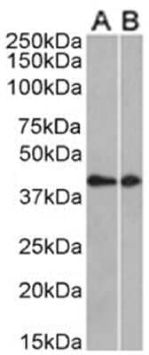 Western Blot: Rat Monoclonal CCRL2/CRAM-A/B Antibody (BZ5B8) [NBP3-11981] -  Mouse thymus (A) and mouse brain (B) tissue lysates (35ug protein in RIPA buffer) were resolved on a SDS PAGE gel and blots were probed with the chimeric rabbit version of CCRL2 (NBP3-11970) at 0.5 ug/ml, before detection using an anti-rabbit secondary antibody. A primary incubation of 1h was used and protein was detected by chemiluminescence.