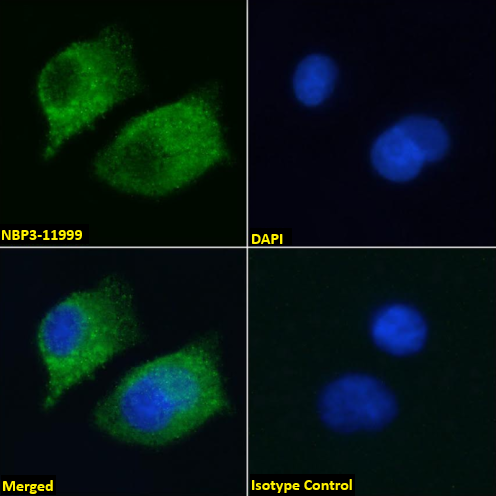 Immunocytochemistry /Immunofluorescence: AGER Antibody (2A11) - Chimeric - Azide and BSA Free [NBP3-11999] - Immunofluorescence analysis of paraformaldehyde fixed A549 cells stained with NBP3-11999 at 10 ug/ml followed by Alexa Fluor(R) 488 secondary antibody (2 ug/ml), showing cytoplasmic staining. The nuclear stain is DAPI (blue). Panels show from left-right, top-bottom: NBP3-11999, DAPI, merged channels and an isotype control. The isotype control was stained with anti-Fluorescein antibody (NBP2-52638) followed by Alexa Fluor(R) 488 secondary antibody.