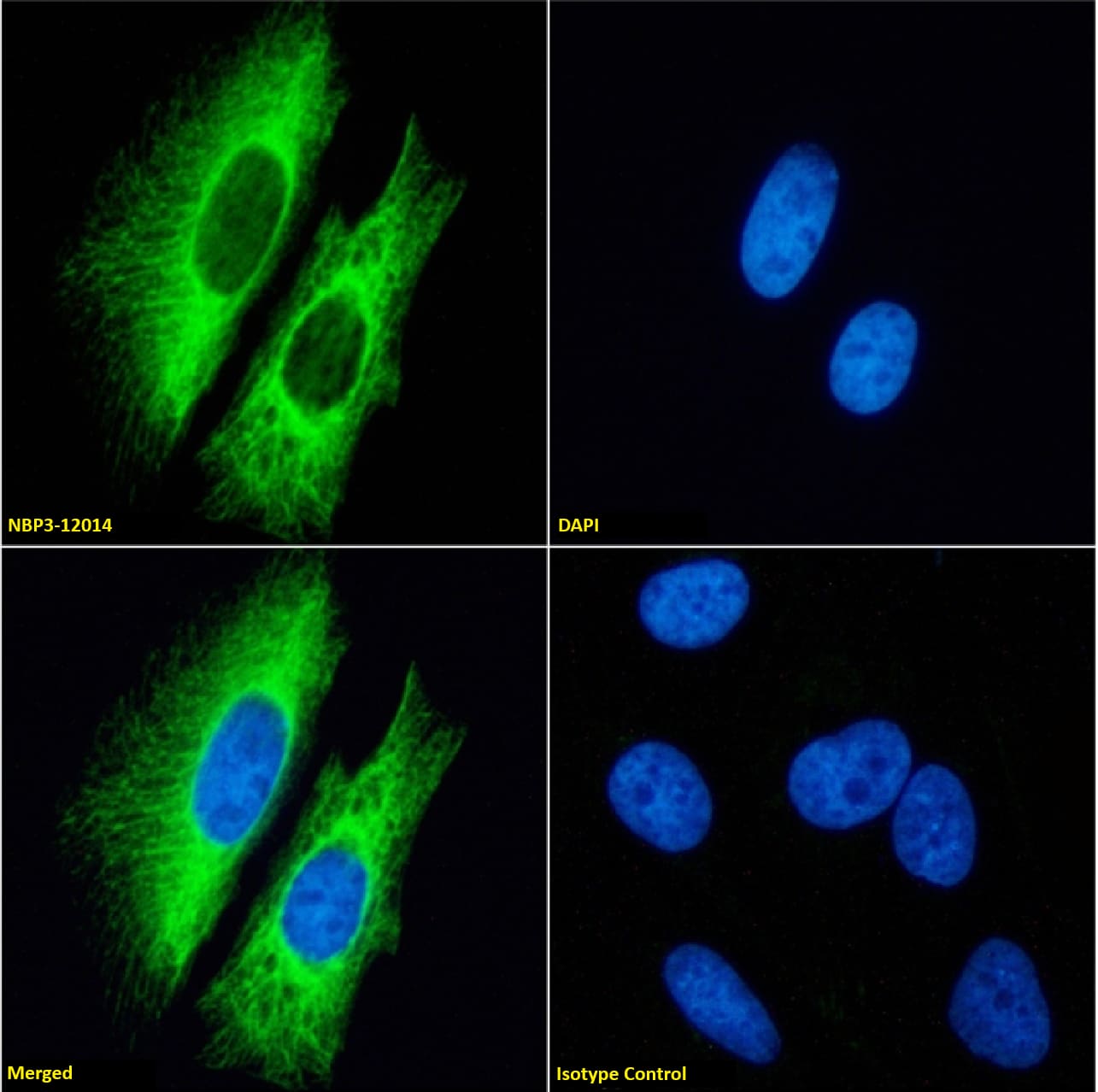 Immunocytochemistry /Immunofluorescence: Cytokeratin 7 Antibody (OV-TL 12/30) - Chimeric - Azide and BSA Free [NBP3-12014] - Immunofluorescence analysis of paraformaldehyde fixed HeLa cells on Shi-fix(TM) coverslips stained with NBP3-12014 at 10 ug/ml for 1h followed by Alexa Fluor(R) 488 secondary antibody (2 ug/ml), showing membrane staining. The nuclear stain is DAPI (blue). Panels show from left-right, top-bottom: NBP3-12014, DAPI, merged channels and an isotype control. The isotype control was an unknown specificity antibody followed by staining with Alexa Fluor(R) 488 secondary antibody.