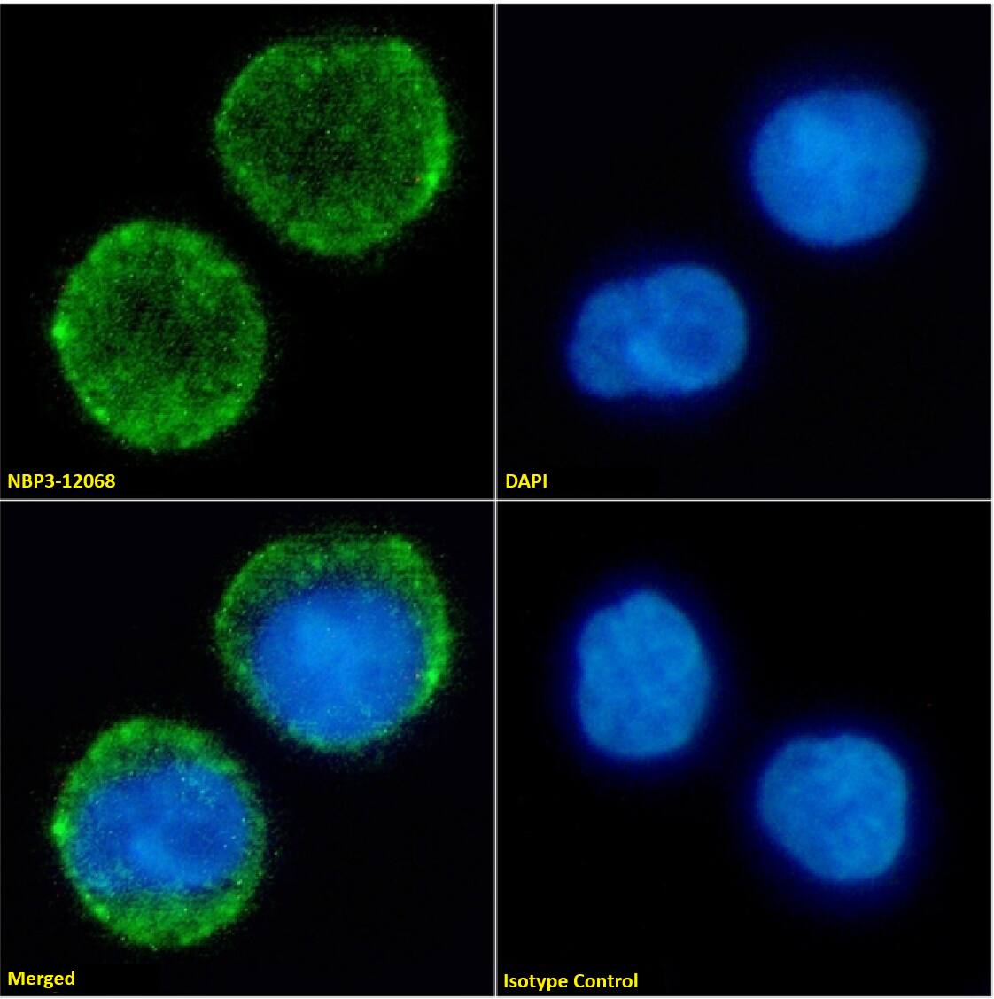 Immunocytochemistry /Immunofluorescence: Neprilysin/CD10 Antibody (FR4D11) - Chimeric - Azide and BSA Free [NBP3-12068] - Immunofluorescence analysis of paraformaldehyde fixed Daudi cells on Shi-fix(TM) coverslips stained with NBP3-12068 at 10 ug/ml for 1h followed by Alexa Fluor(R) 488 secondary antibody (2 ug/ml), showing membrane staining. The nuclear stain is DAPI (blue). Panels show from left-right, top-bottom NBP3-12068, DAPI, merged channels and an isotype control. The isotype control was an unknown specificity antibody followed by staining with Alexa Fluor(R) 488 secondary antibody.