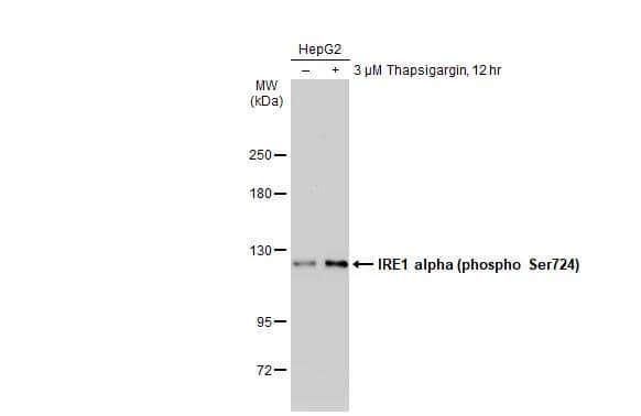 Untreated (-) and treated (+) HepG2 whole cell extracts (30 ug) were separated by 5% SDS-PAGE, and the membrane was blotted with IRE1 alpha (phospho Ser724) antibody (NBP3-12124) diluted at 1:1000. The HRP-conjugated anti-rabbit IgG antibody  was used to detect the primary antibody. 