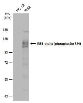 Various whole cell extracts (30 ug) were separated by 7.5% SDS-PAGE, and the membrane was blotted with IRE1 alpha (phospho Ser724) antibody (NBP3-12124) diluted at 1:1000. The HRP-conjugated anti-rabbit IgG antibody  was used to detect the primary antibody. 
