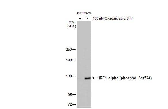 Untreated (-) and treated (+) Neuro2A whole cell extract (30 ug) were separated by 5% SDS-PAGE, and the membrane was blotted with IRE1 alpha (phospho Ser724) antibody (NBP3-12124) diluted at 1:1000. The HRP-conjugated anti-rabbit IgG antibody  was used to detect the primary antibody, and the signal was developed with Trident ECL plus-Enhanced. 