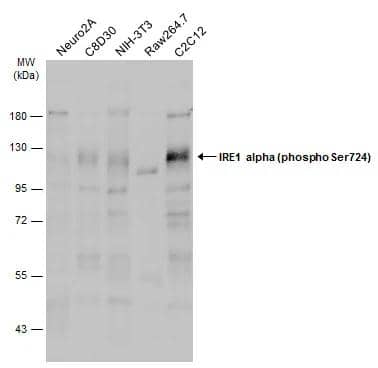 Various whole cell extracts (30 ug) were separated by 7.5% SDS-PAGE, and the membrane was blotted with IRE1 alpha (phospho Ser724) antibody (NBP3-12124) diluted at 1:1000. The HRP-conjugated anti-rabbit IgG antibody  was used to detect the primary antibody. 