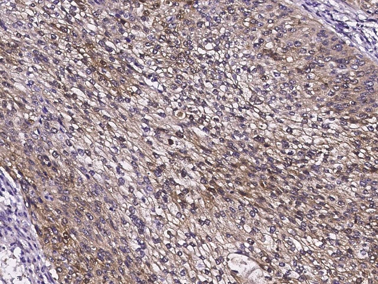 Immunohistochemistry-Paraffin gamma-Glutamylcyclotransferase/CRF21/GGCT Antibody - Azide and BSA Free
